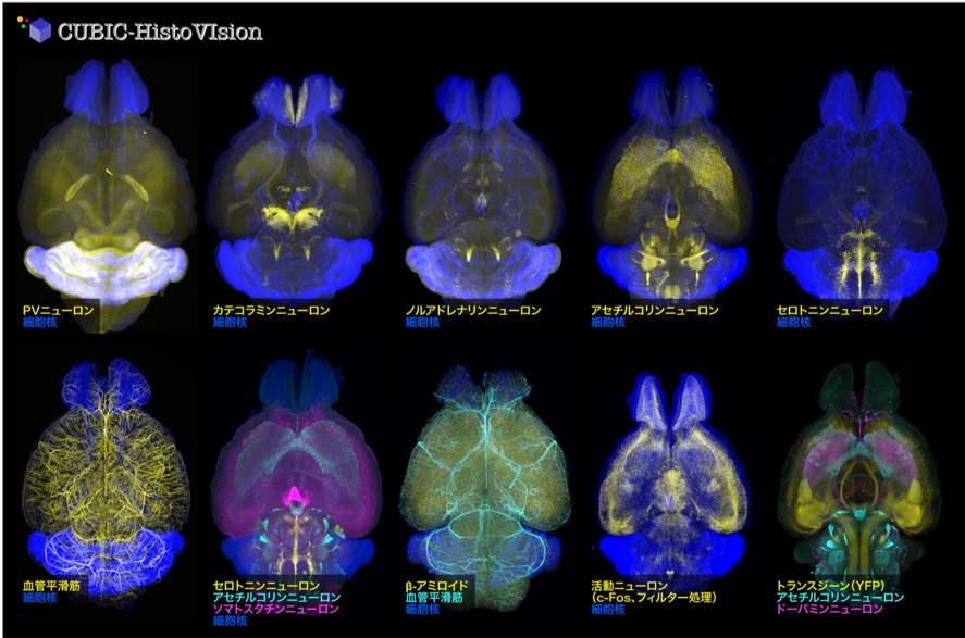 図3 マウス全脳を用いたCUBIC-HVの実施例